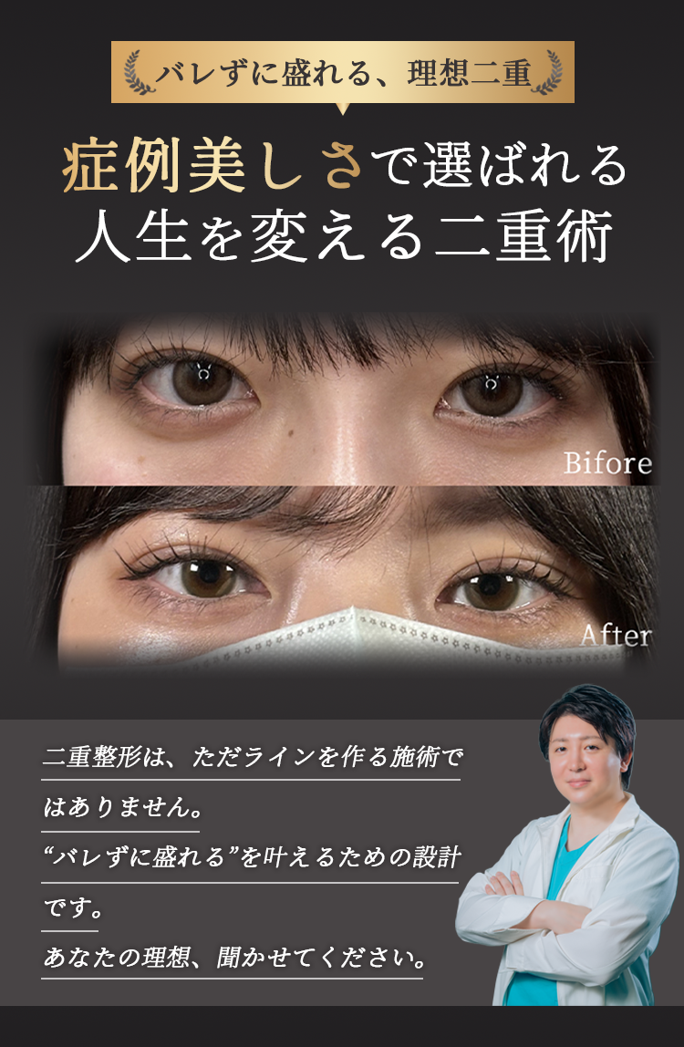 症例美しさで選ばれる 人生を変える二重術
