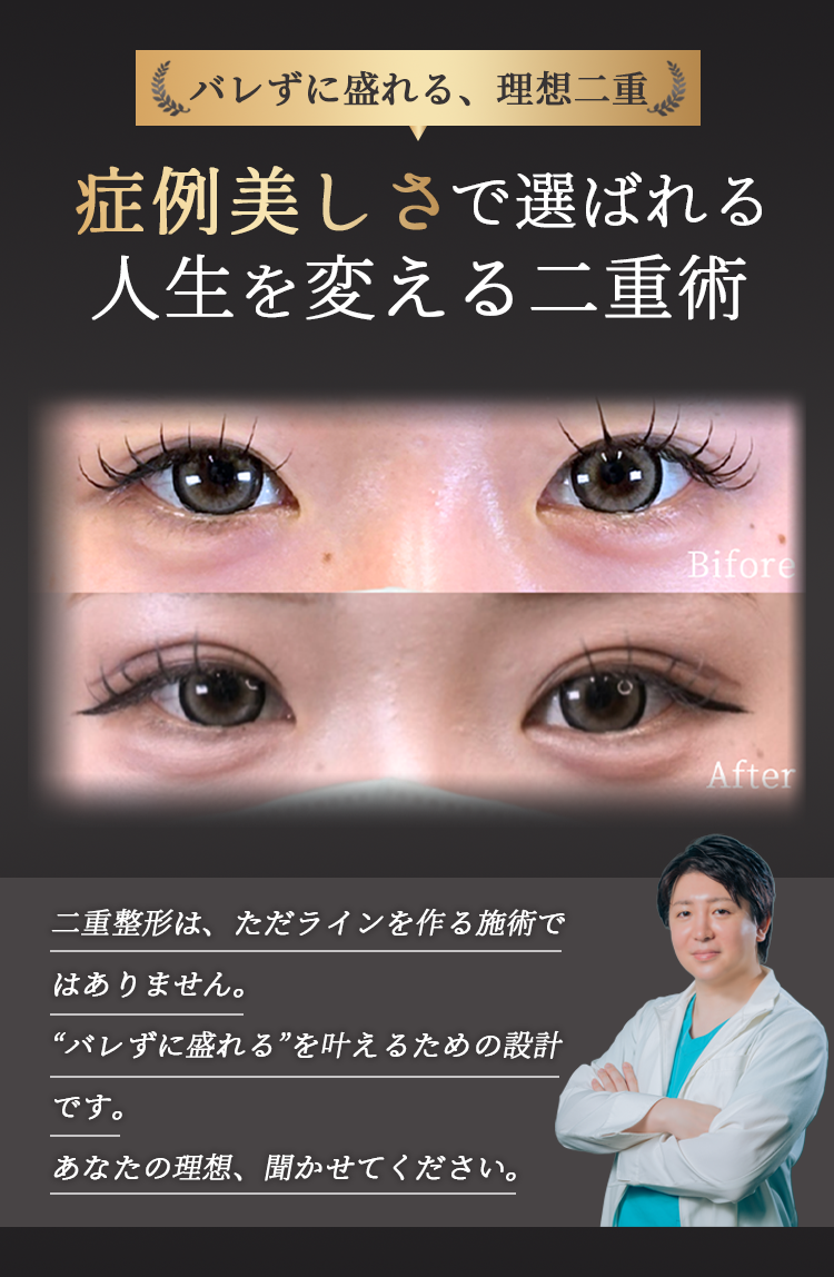 症例美しさで選ばれる 人生を変える二重術