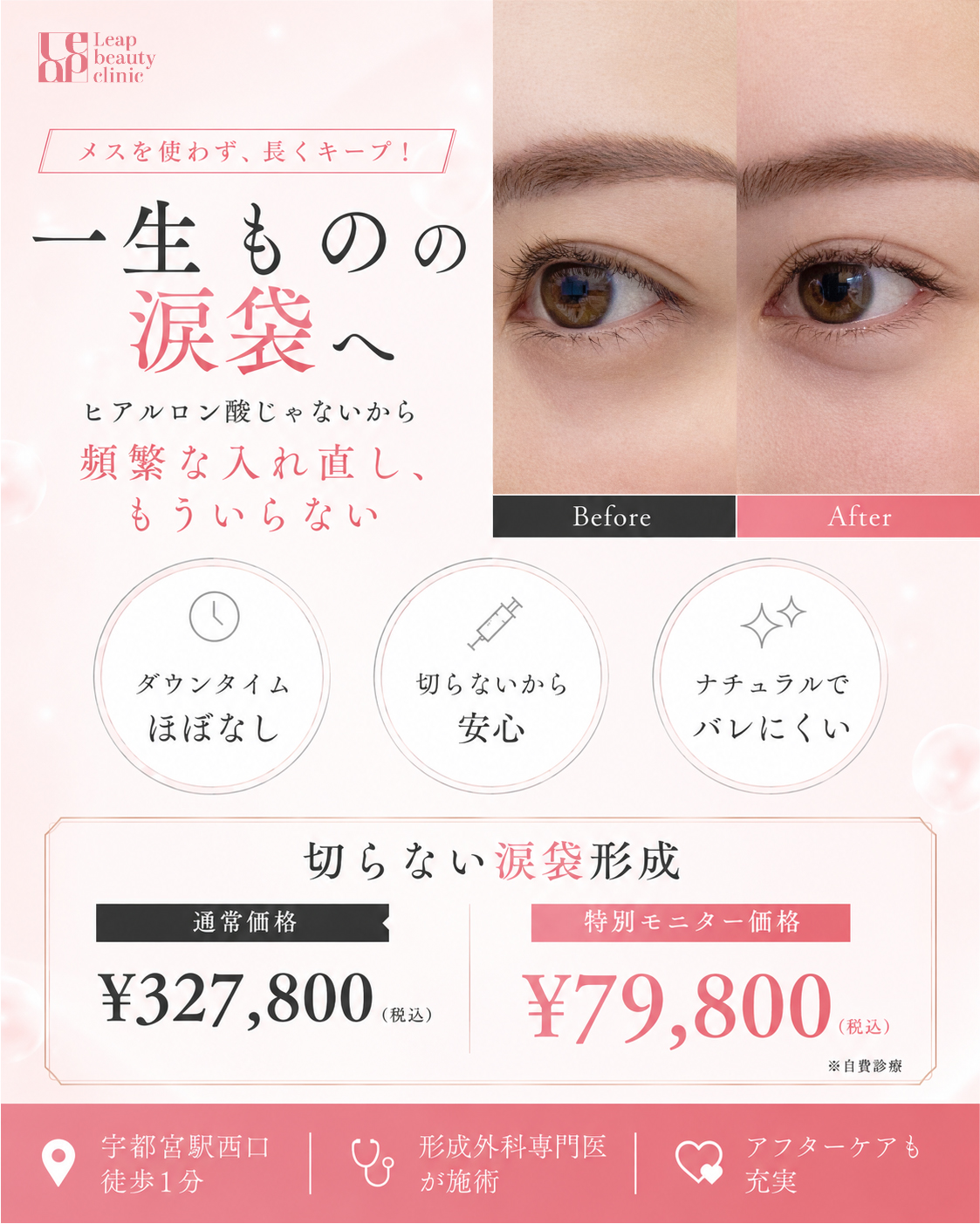自然でバレない。切らない涙袋形成。モニター価格79,800円