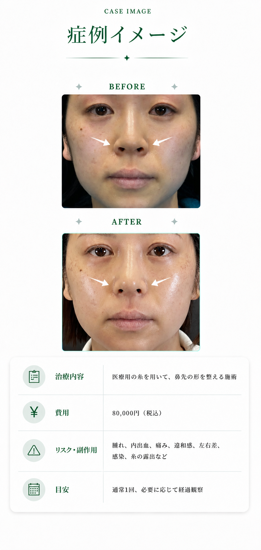 症例イメージ。治療内容、費用、リスク・副作用、目安