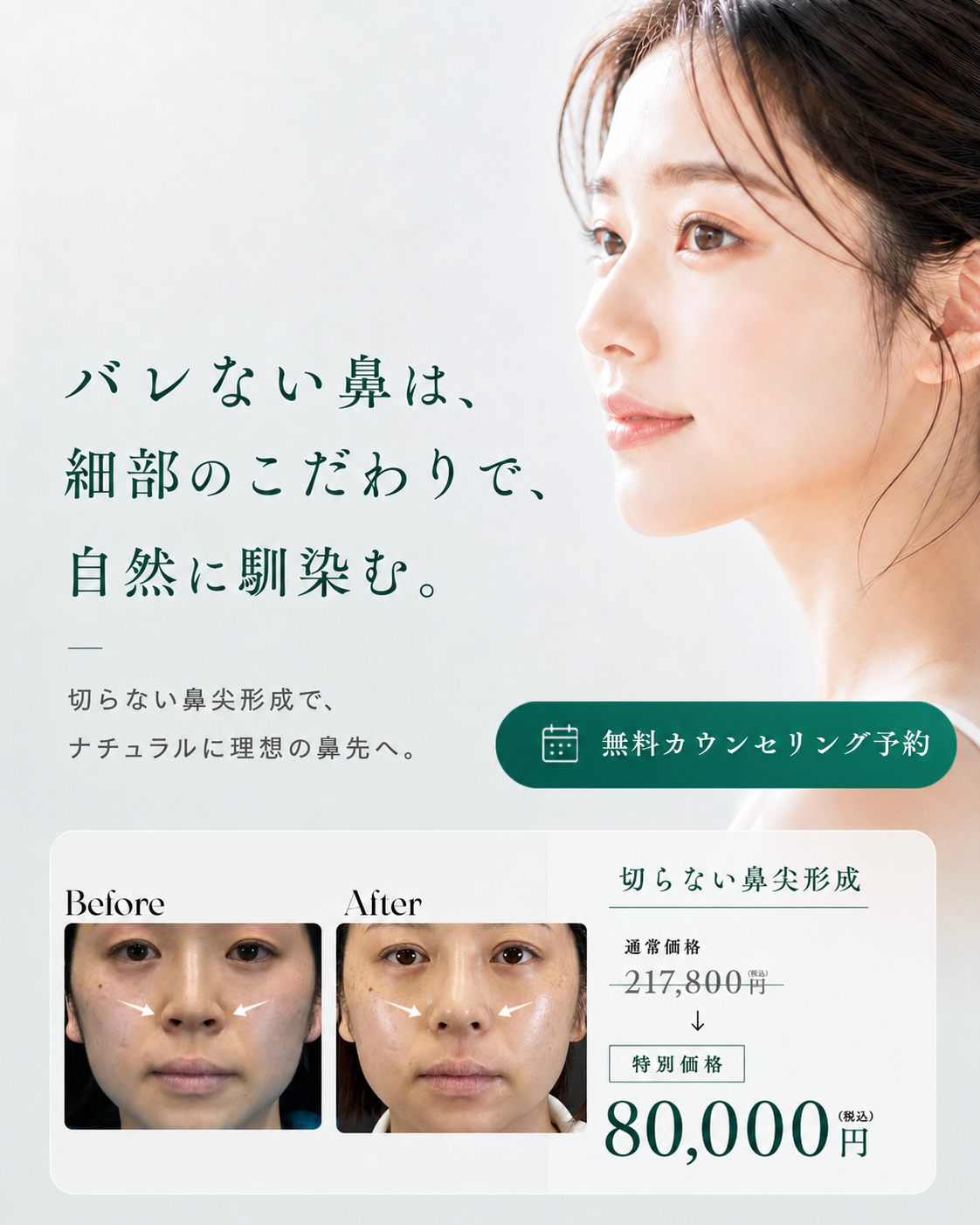 バレない鼻は、細部のこだわりで自然に馴染む。無料カウンセリング予約。切らない鼻尖形成 特別価格77,000円税込