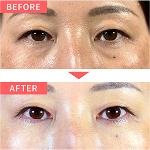 BEFORE AFTER