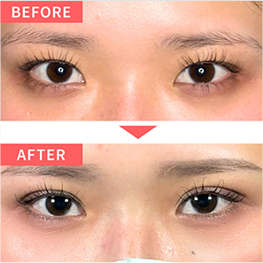 BEFORE AFTER
