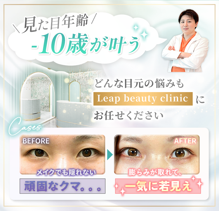見た目年齢-10歳が叶う どんな目元の悩みも Leap Beauty Clinic にお任せください BEFORE メイクでも隠れない 頑固なクマ。。。 → AFTER 膨らみが取れて、一気に若見え