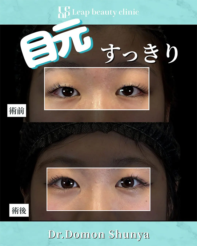 【症例写真：当院での施術症例とビフォーアフター】