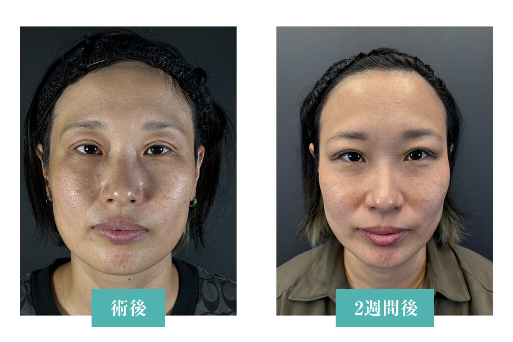 【症例写真：術後1日目〜1週間の経過】