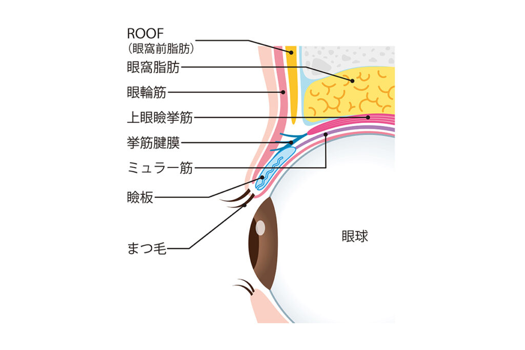 二重埋没はなぜ腫れるの？医師が教える「腫れの3大原因」