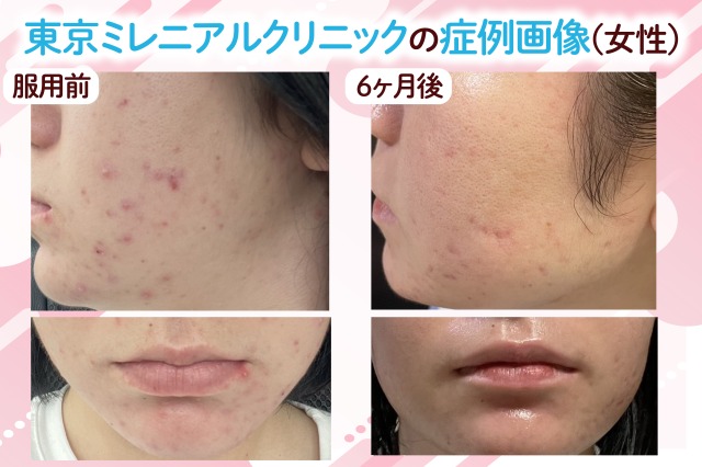 東京ミレニアルクリニックの女性の症例写真