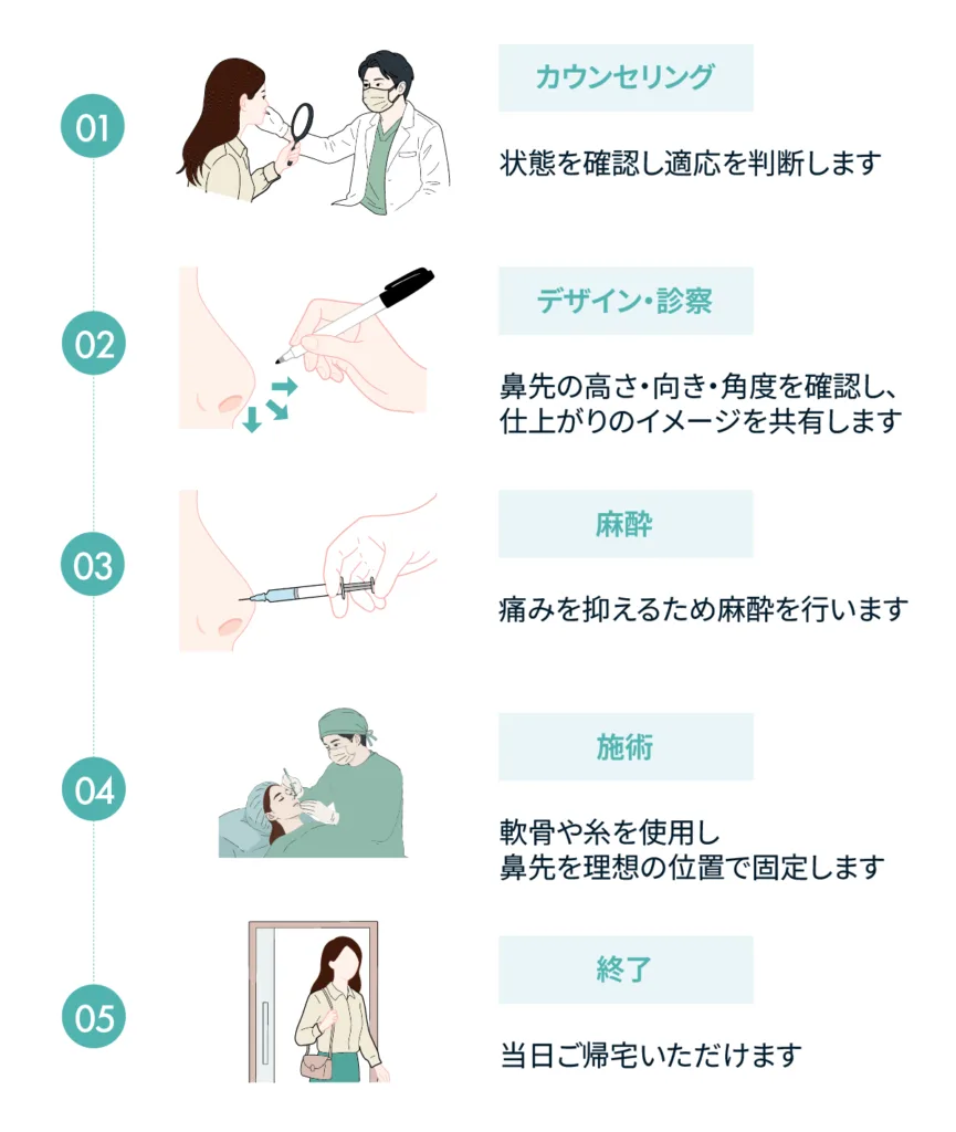 鼻中隔延長のカウンセリングから帰宅までの流れの図(Leap beauty clinic)