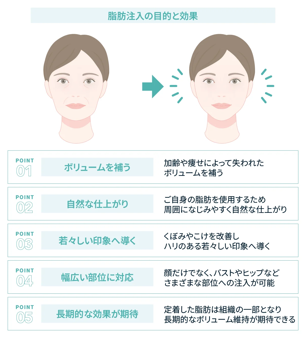 脂肪注入の目的と効果の図。加齢や痩せで失われたボリュームを自身の脂肪で補い、くぼみやこけを改善して定着した脂肪の長期的な維持が期待できる5つのポイント(Leap beauty clinic)