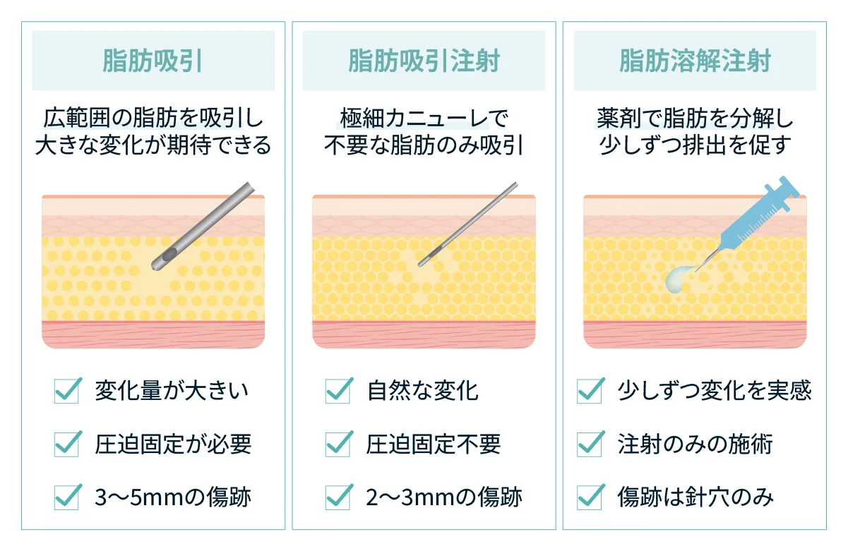脂肪吸引・脂肪吸引注射・脂肪溶解注射を、脂肪の減らし方・変化の大きさ・圧迫固定の要否・傷跡の大きさで比べた図(Leap beauty clinic)