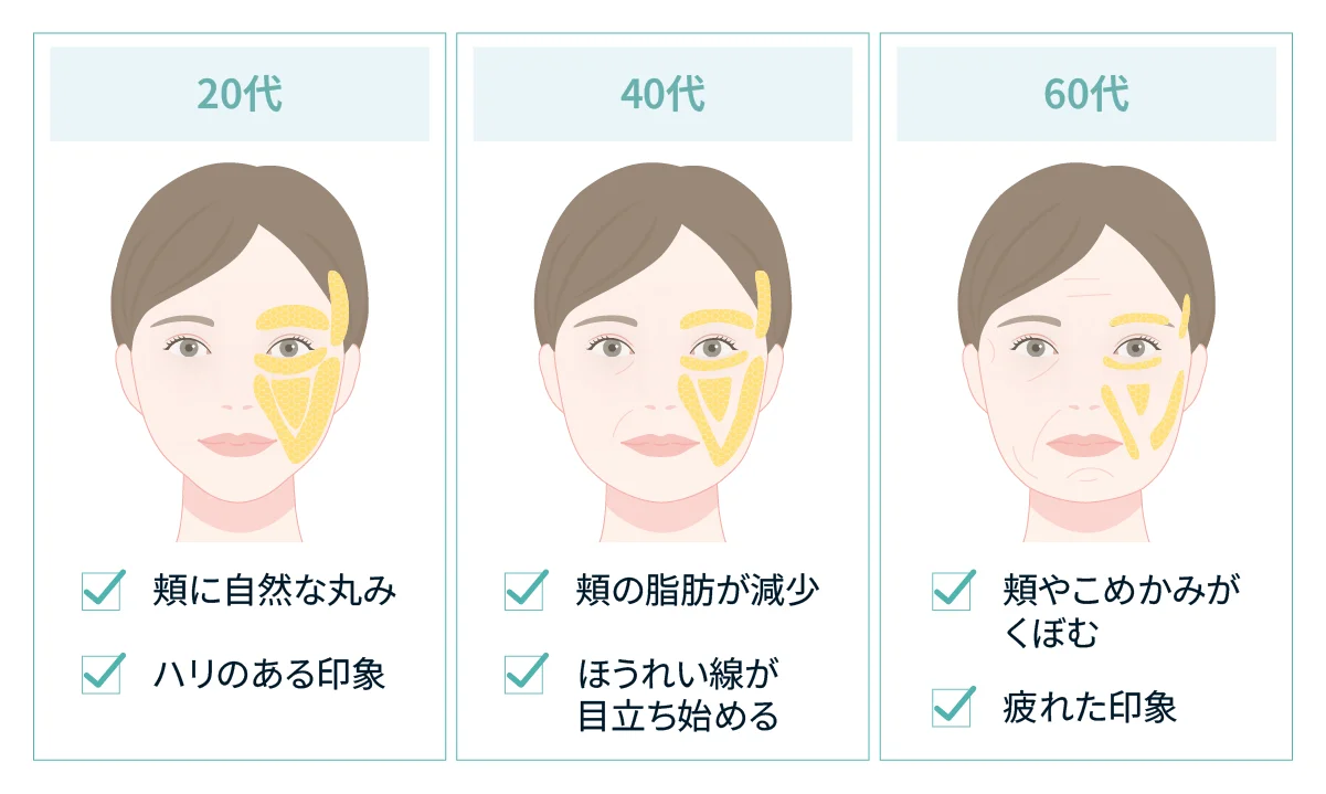 20代・40代・60代の顔を並べ、年齢とともに頬の脂肪が減り、60代で頬やこめかみがくぼんで疲れた印象になる変化を示した図（Leap beauty clinic）